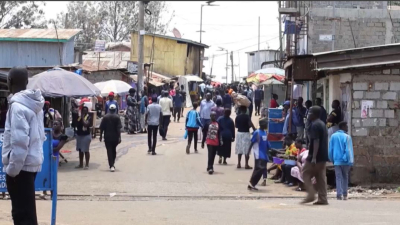 Әлемде жылына 7 мың бүйрек сатылады